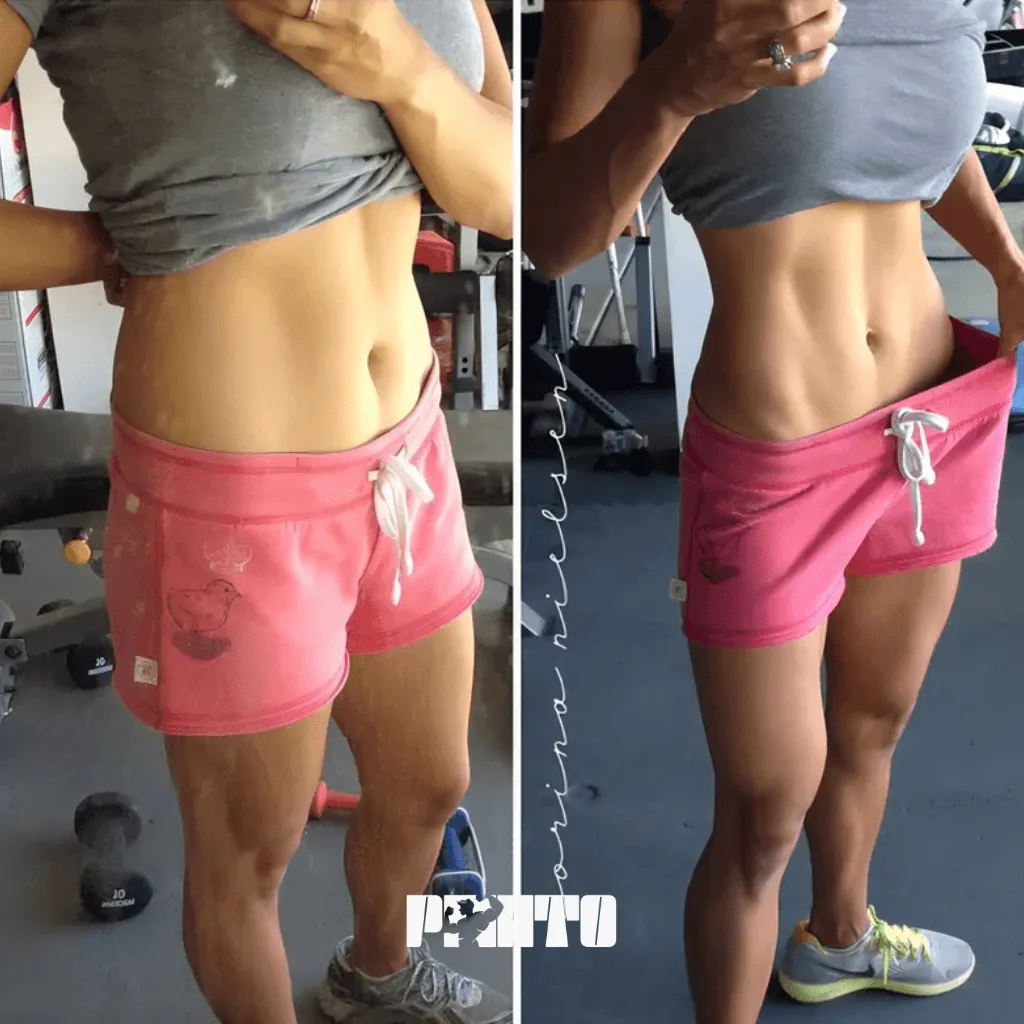 Antes e depois com resultado de uso do aparelho